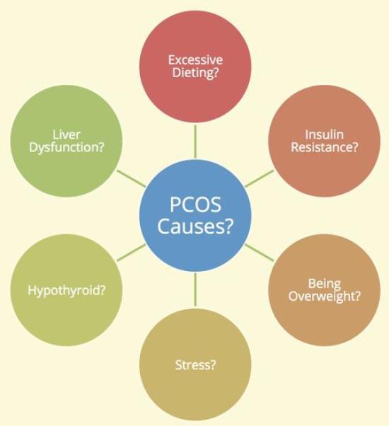 Causes of PCOS Image